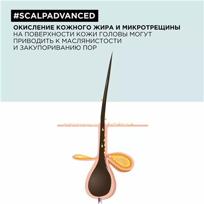 Шампунь Scalp Advanced для жирных волос, 300 мл