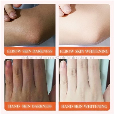 Отбеливающий крем Sadoer Whitening Dark Knuckle Cream 140g (19)