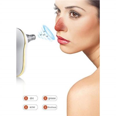 Электрический вакуумный прибор для удаление черных точек на носу оптом