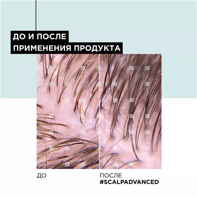 Шампунь Scalp Advanced для жирных волос, 300 мл